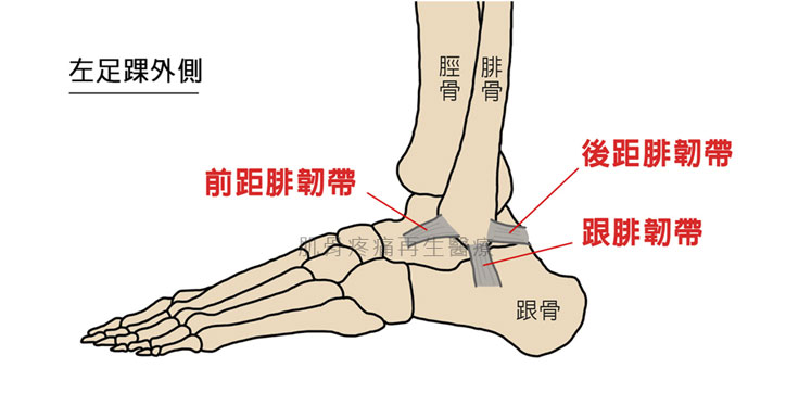 足踝扭傷最常傷及前距腓韌帶